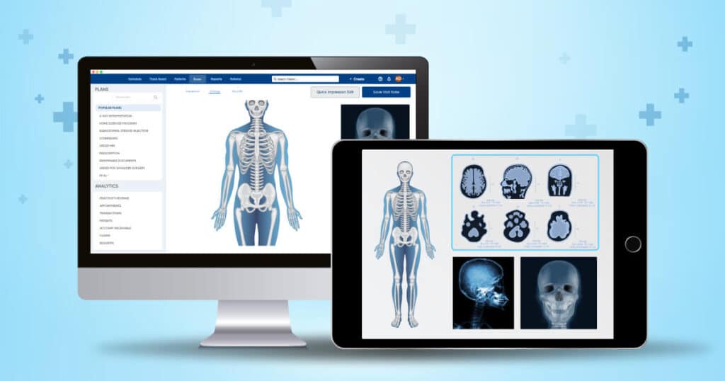 meta-3-1024x538 Integrating Orthopedic EMR with Imaging Technologies: Process and Benefits